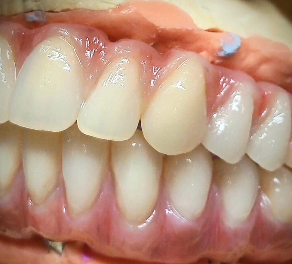 Prosthetics Dental Technician Goes Freelance!